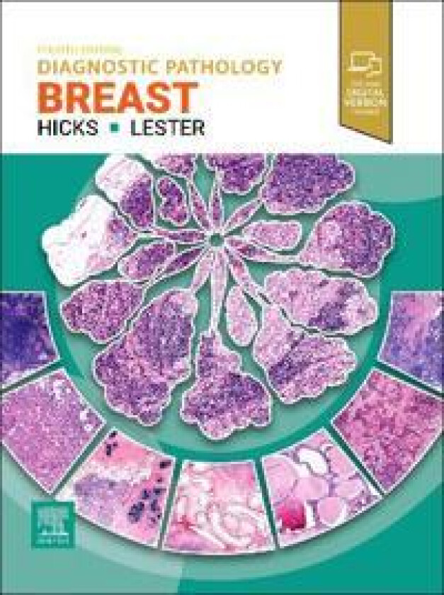 Bilde av Diagnostic Pathology: Breast