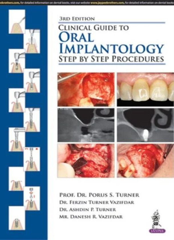 Clinical Guide to Oral Implantology av Porus S Turner, Ferzin Turner Vazifdar, Ashdin P Turner, Danesh R Vazifdar