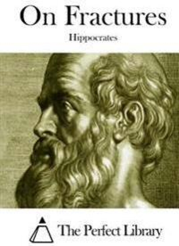 On Fractures