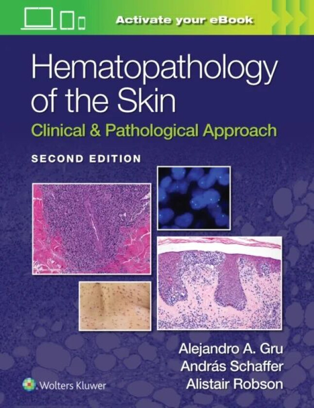 Hematopathology of the Skin av Alejandro Ariel Gru, ANDRAS SCHAFFER, ALISTAIR ROBSON