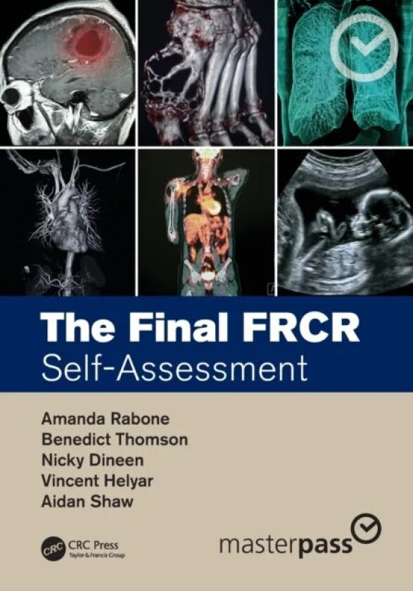 The Final FRCR av Amanda (MTW NHS Trust UK) Rabone, Benedict (GSTT NHS Trust UK) Thomson, Nicky (MTW NHS Trust UK) Dineen, Vincent (HHFT NHS UK) Helya
