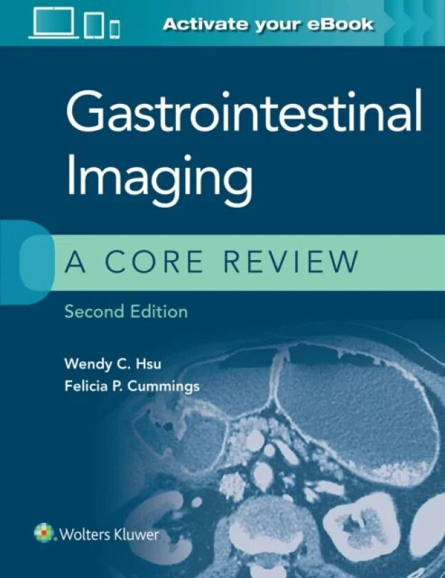 Gastrointestinal Imaging: A Core Review av Wendy C. Hsu, Felicia P. Cummings