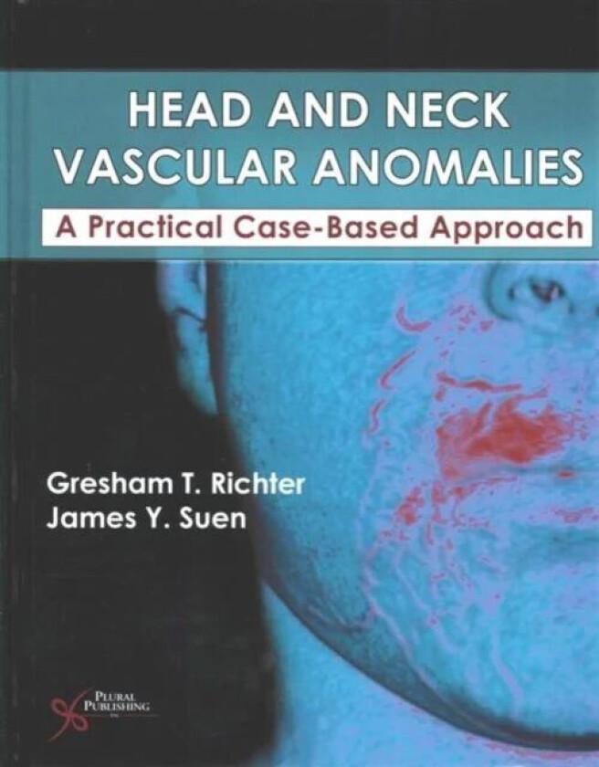 Head and Neck Vascular Anomalies av Gresham T. Richter, James Y. Suen