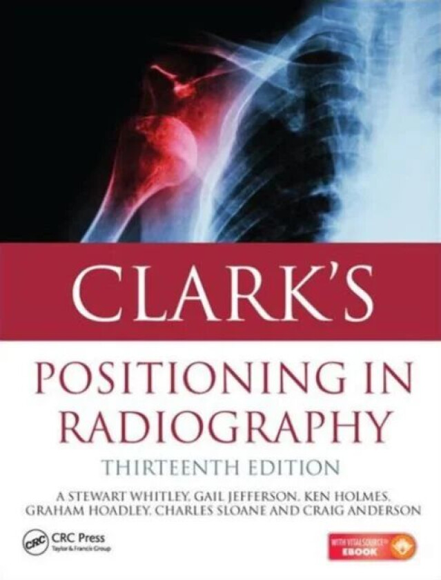Clark's Positioning in Radiography 13E av A. Stewart Whitley, Gail Jefferson, Ken (University of Cumbria UK) Holmes, Charles (University of Cumbr