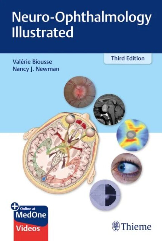 Neuro-Ophthalmology Illustrated av Valerie Biousse, Nancy Newman