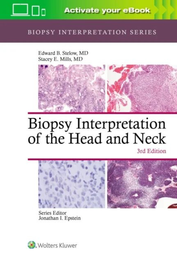 Biopsy Interpretation of the Head and Neck av Edward B. Stelow, Stacey Mills