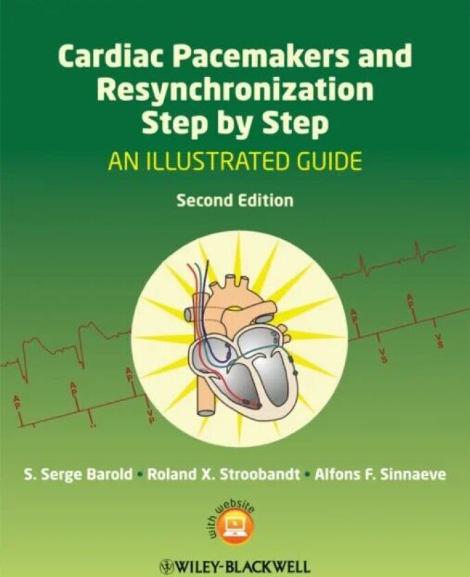 Cardiac Pacemakers and Resynchronization Step by Step av S. Serge (University of South Florida and Florida Heart Rhythm Institute) Barold, Roland X. S