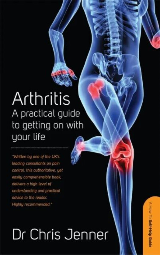 Arthritis av DR Chris MB BS FRCA FFPMRCA Jenner