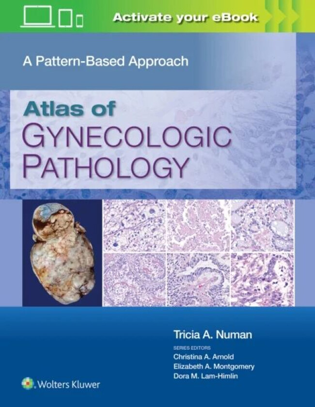 Bilde av Atlas of Gynecologic Pathology av Tricia A. MD Numan