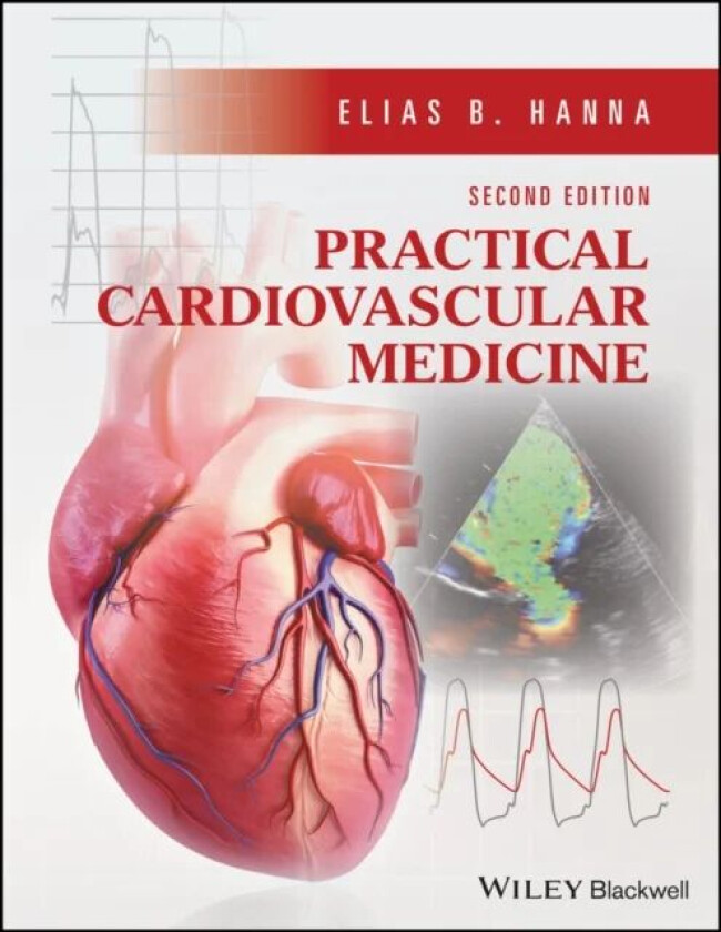 Practical Cardiovascular Medicine av Elias B. (Louisiana State University School of Medicine New Orleans LA USA) Hanna