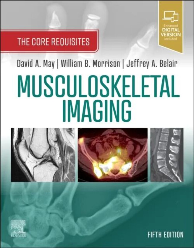 Musculoskeletal Imaging av David A. (Radiology Associates Richmond VA May, Department of Radiology Virginia Commonwealth University Medical College of