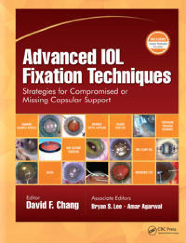 Bilde av Advanced IOL Fixation Techniques