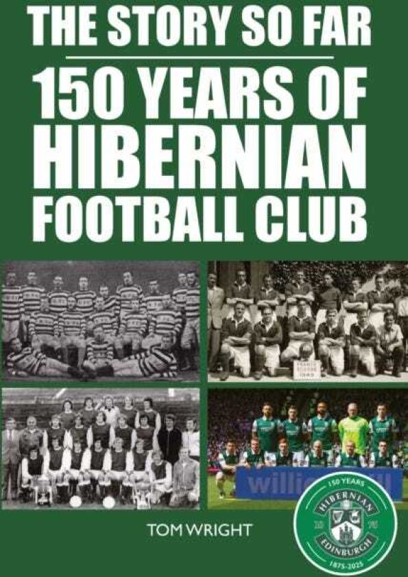 The Story so Far 150 Years of Hibernian Football Club
