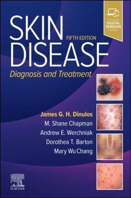 Skin Disease Diagnosis and Treatment