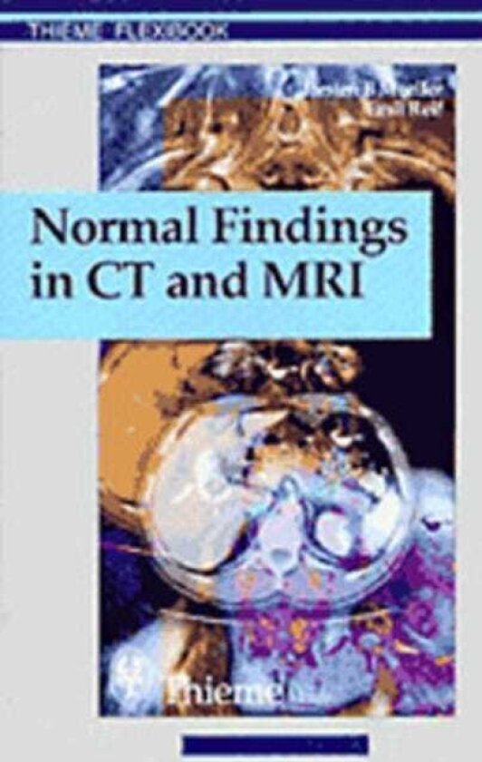 Normal Findings in CT and MRI, A1, Print