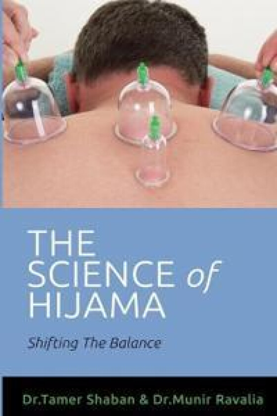 The science of hijama