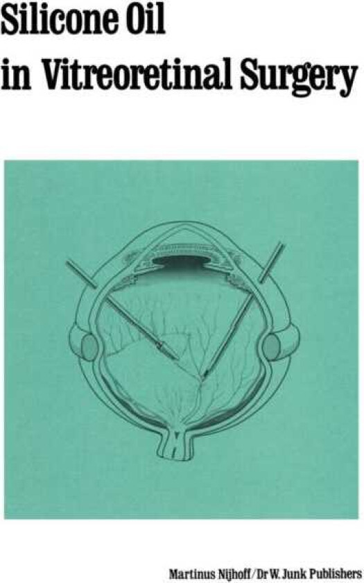 Silicone Oil in Vitreoretinal Surgery