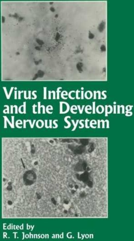 Virus Infections and the Developing Nervous System
