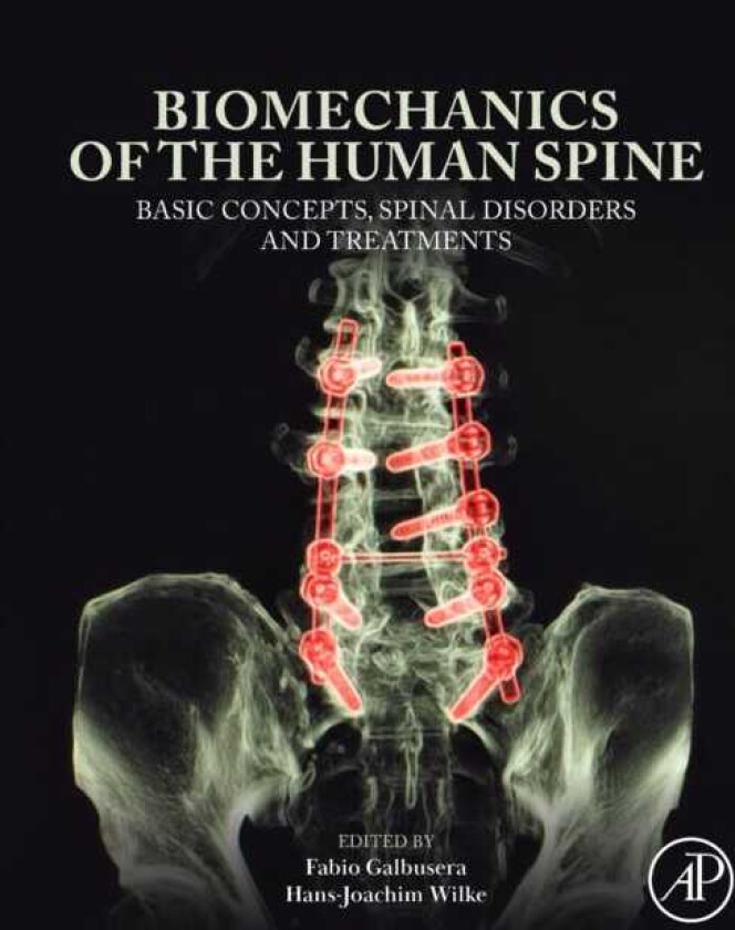 Biomechanics of the Human Spine Basic Concepts, Spinal Disorders and Treatments