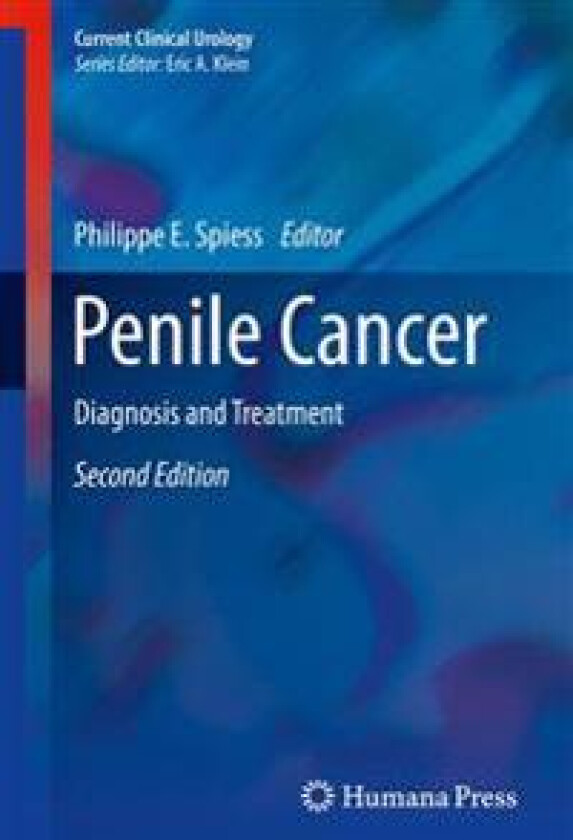 Penile Cancer