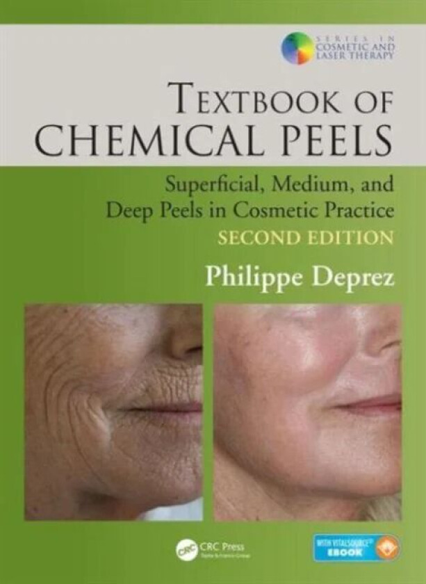 Textbook of Chemical Peels av Philippe (Clinical Hera Empuriabrava Spain) Deprez