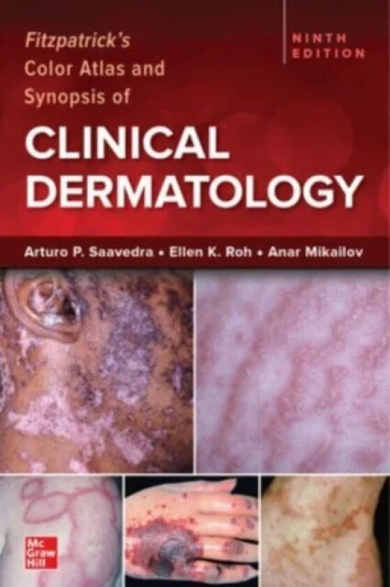 Fitzpatrick's Color Atlas and Synopsis of Clinical Dermatology, Ninth Edition av Arturo Saavedra, Ellen Roh, Anar Mikailov