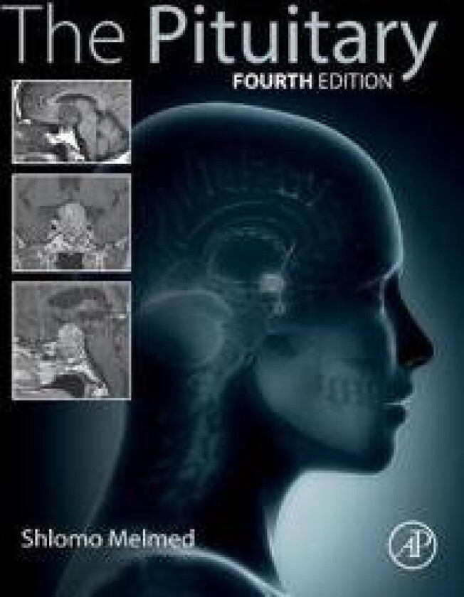 The Pituitary