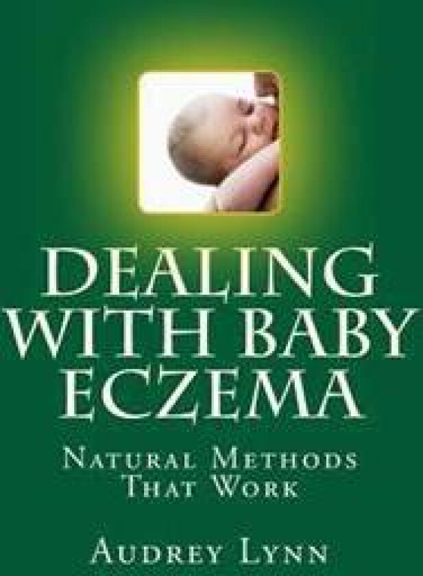 Dealing with Baby Eczema: Natural Methods That Work