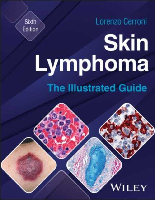 Skin Lymphoma The Illustrated Guide