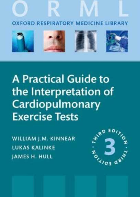 A Practical Guide to the Interpretation of Cardiopulmonary Exercise Tests