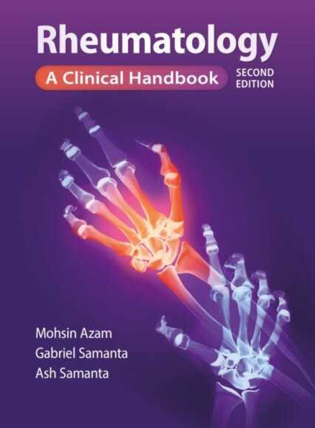 Rheumatology, second edition A clinical handbook