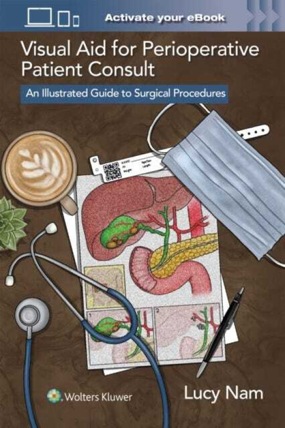 Visual Aid for Perioperative Patient Consult An Illustrated Guide to Surgical Procedures