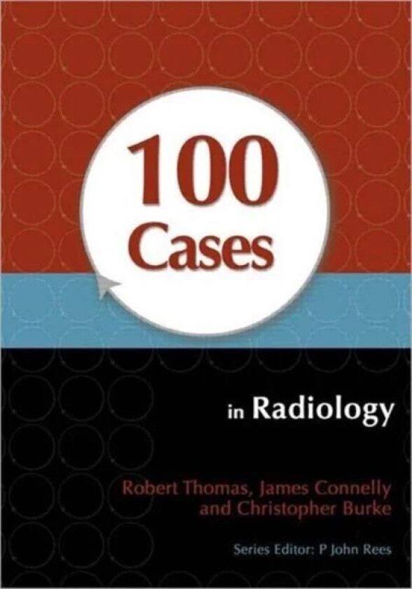 100 Cases in Radiology av Robert (Scientific Solutions Gaithersburg Maryland USA) Thomas, James (Cranbrook UK) Connelly, Christopher (Specialist Regis