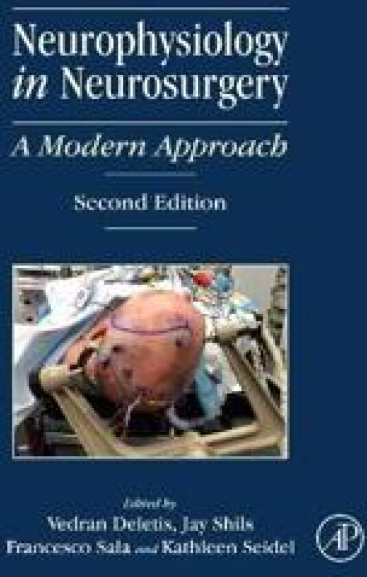 Neurophysiology in Neurosurgery