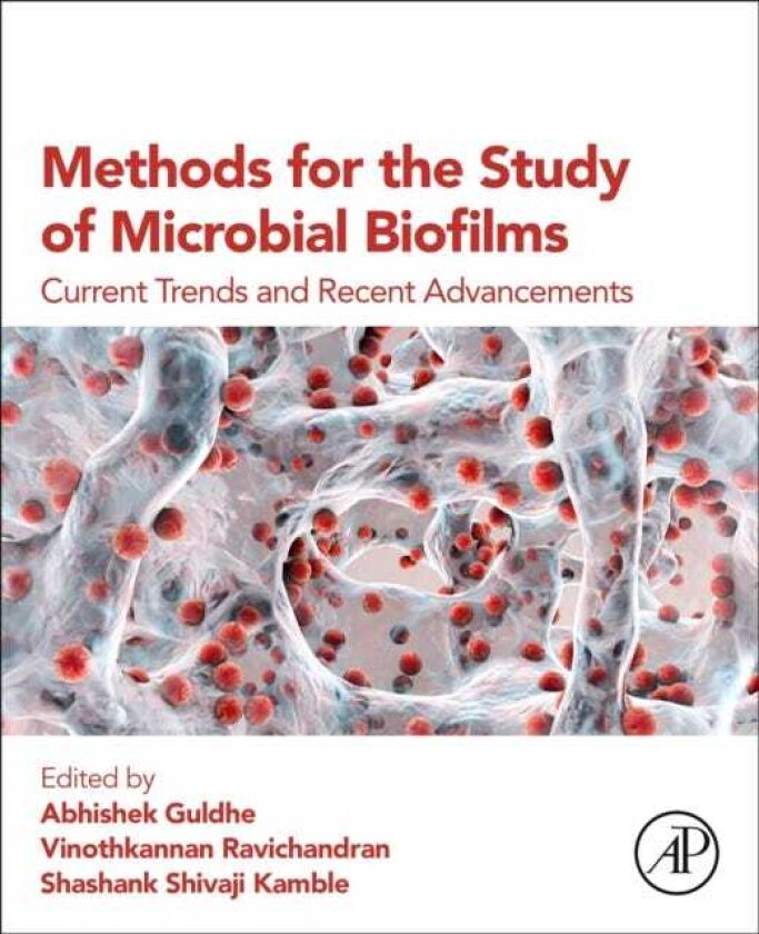 Methods for the Study of Microbial Biofilms Current Trends and Recent Advancements