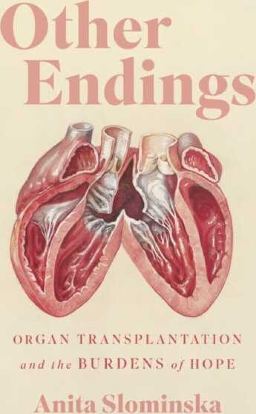 Other Endings Organ Transplantation and the Burdens of Hope