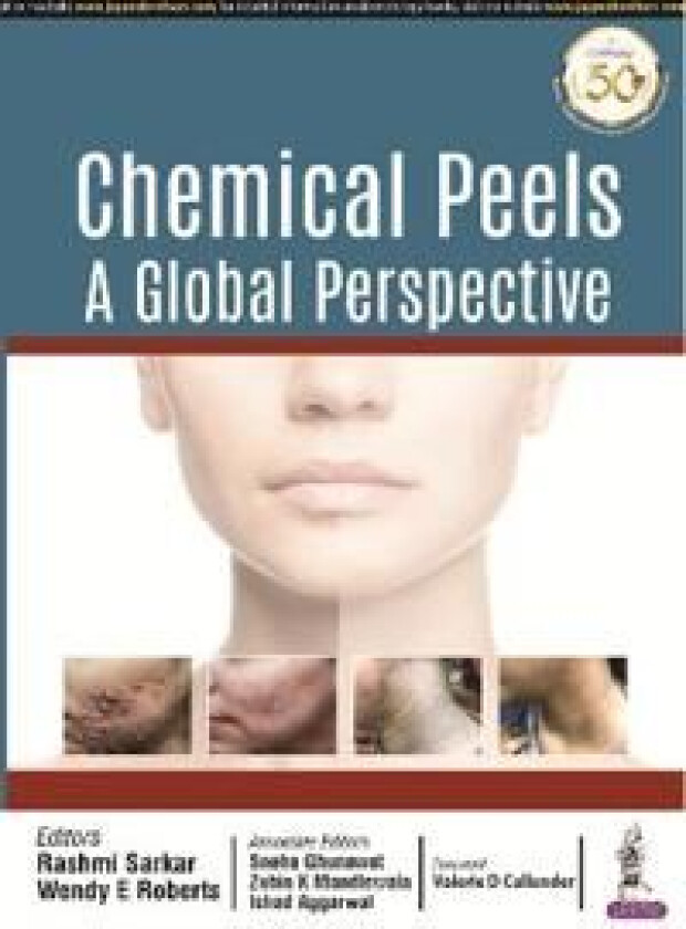 Chemical Peels: A Global Perspective