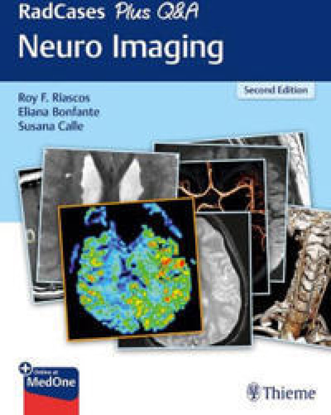 RadCases Plus Q&A Neuro Imaging