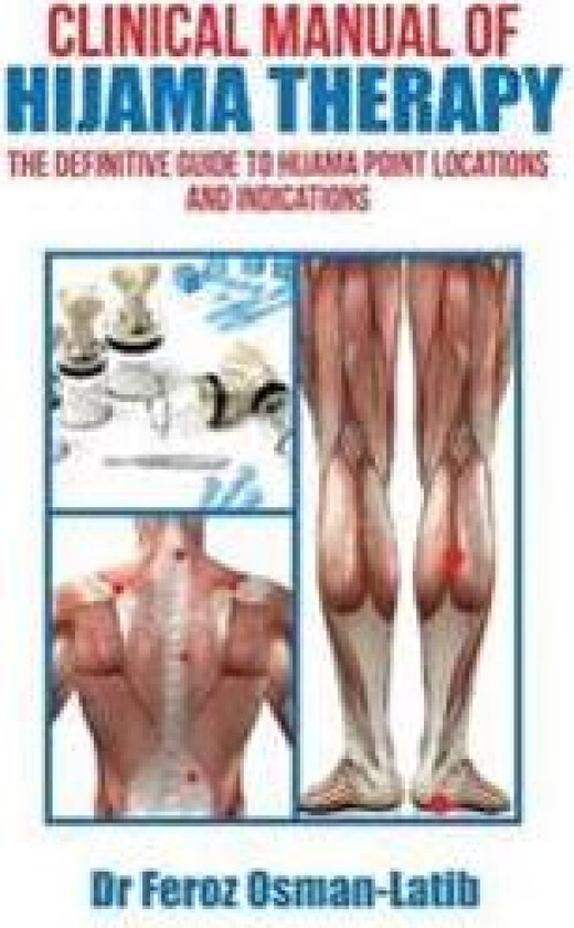 Clinical Manual of Hijama Therapy