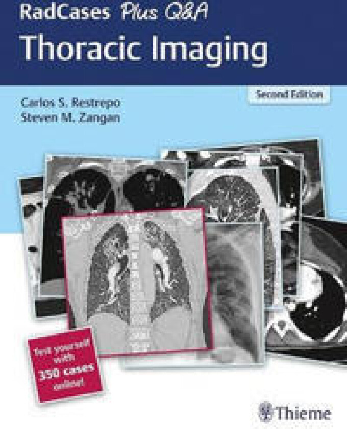 RadCases Plus Q&A Thoracic Imaging