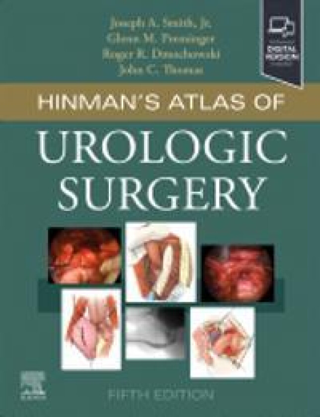 Bilde av Hinman's Atlas of Urologic Surgery