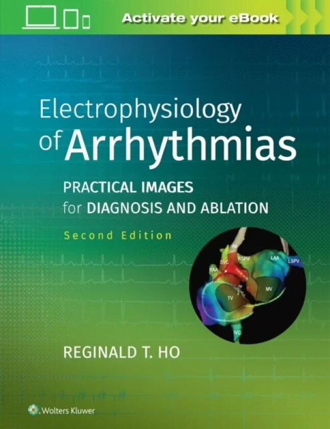 Electrophysiology of Arrhythmias av Reginald T. Ho