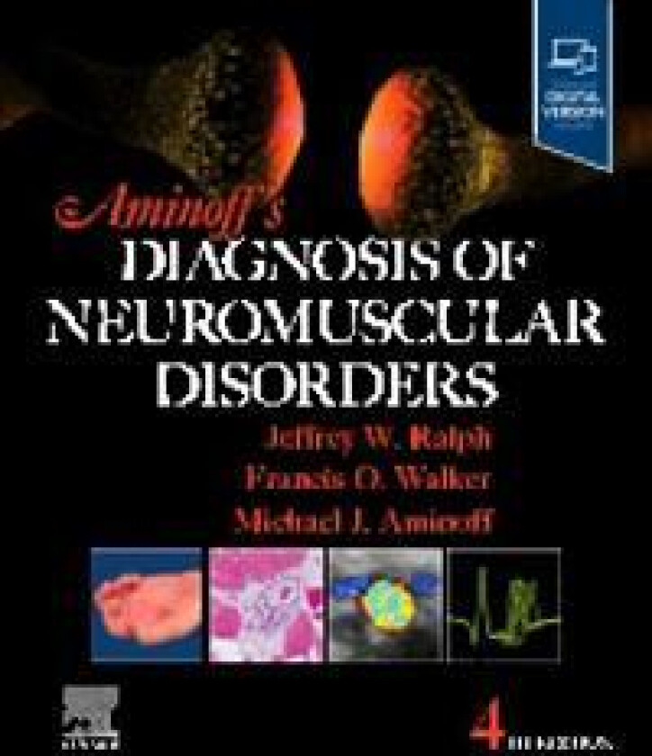 Aminoff's Diagnosis of Neuromuscular Disorders