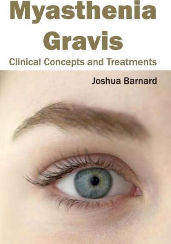 Myasthenia Gravis: Clinical Concepts and Treatments