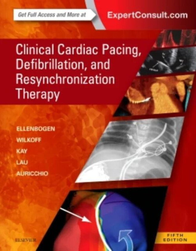 Clinical Cardiac Pacing, Defibrillation and Resynchronization Therapy av Kenneth A. (Kontos Professor of Medici Ellenbogen