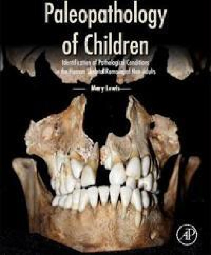 Paleopathology of Children