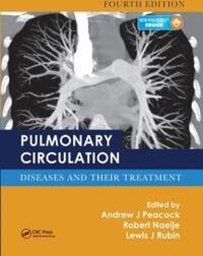 Pulmonary Circulation