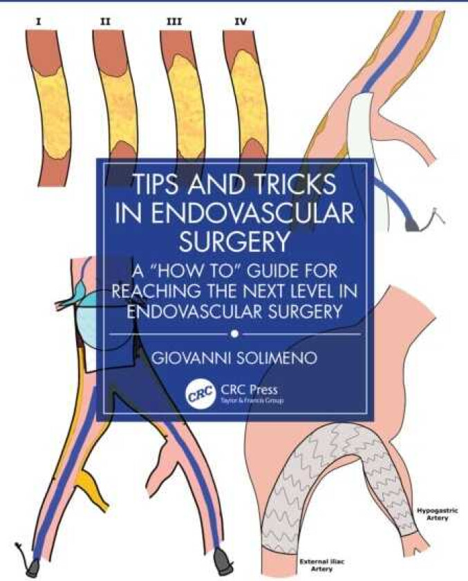 Tips and Tricks in Endovascular Surgery A "How to" Guide for reaching the next Level in Endovascular Surgery