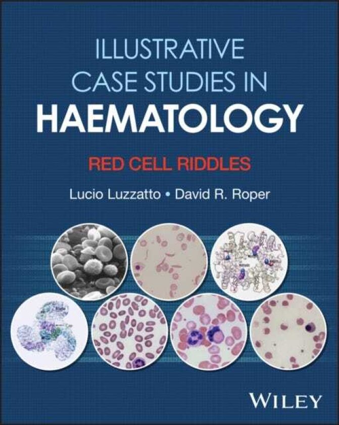 Illustrative Case Studies in Haematology Red Cell Riddles