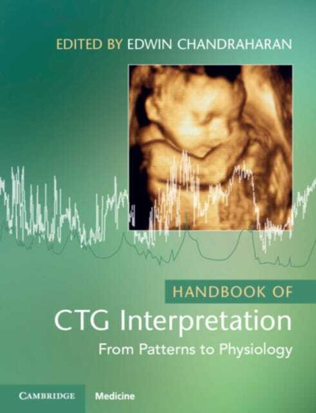 Handbook of CTG Interpretation From Patterns to Physiology